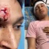 mumbai student beaten 11zon