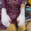 Delhi: DU Student Attacked with Acid Outside Laxmibai College, Suffers Burns on Hands 65 Delhi University acid attack