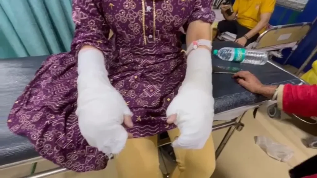 Delhi University acid attack