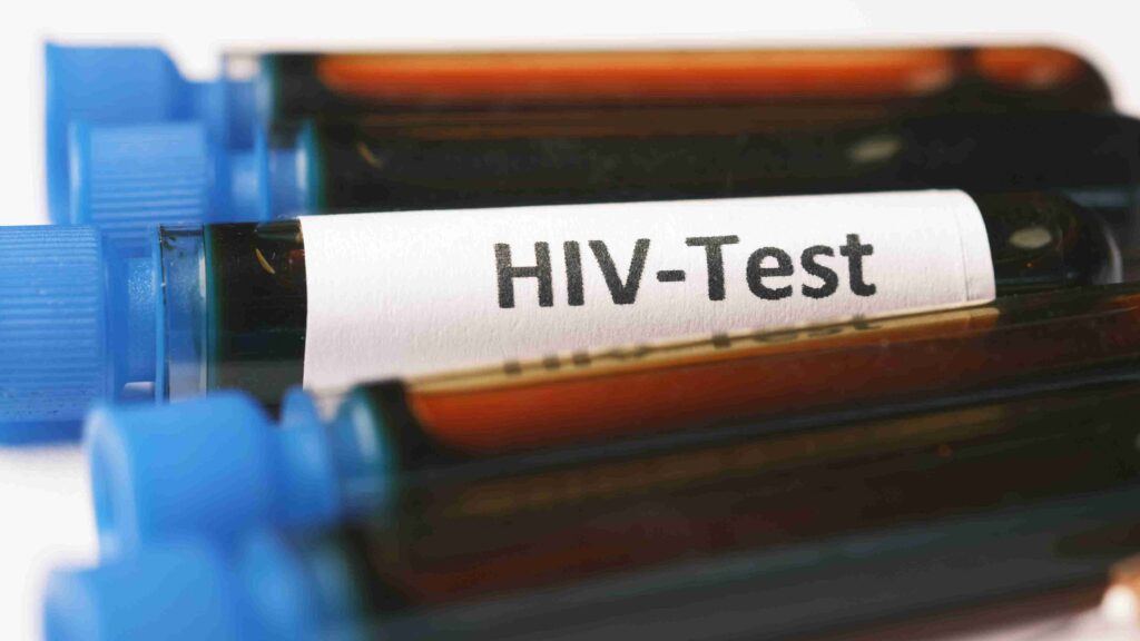 Over 7,400 HIV Cases Detected in Bihar’s Sitamarhi, Including 400 Children: ART Centre