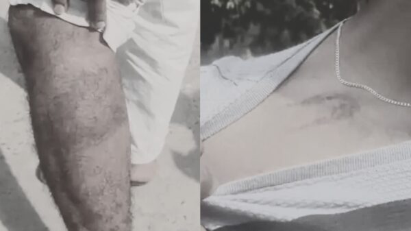 Dalit Student Beaten Near Hostel in Gujarat’s Mehsana