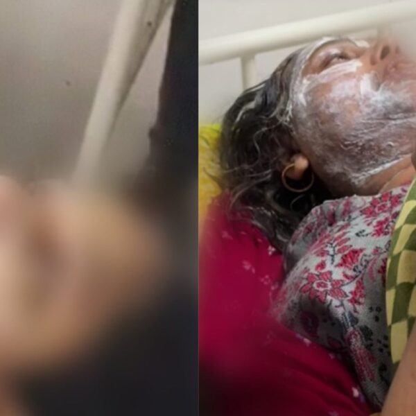 A jeweller in Bihar's Madhepura allegedly threw acid on a mother and daughter who visited his shop to collect jewellery ahead of a family wedding.