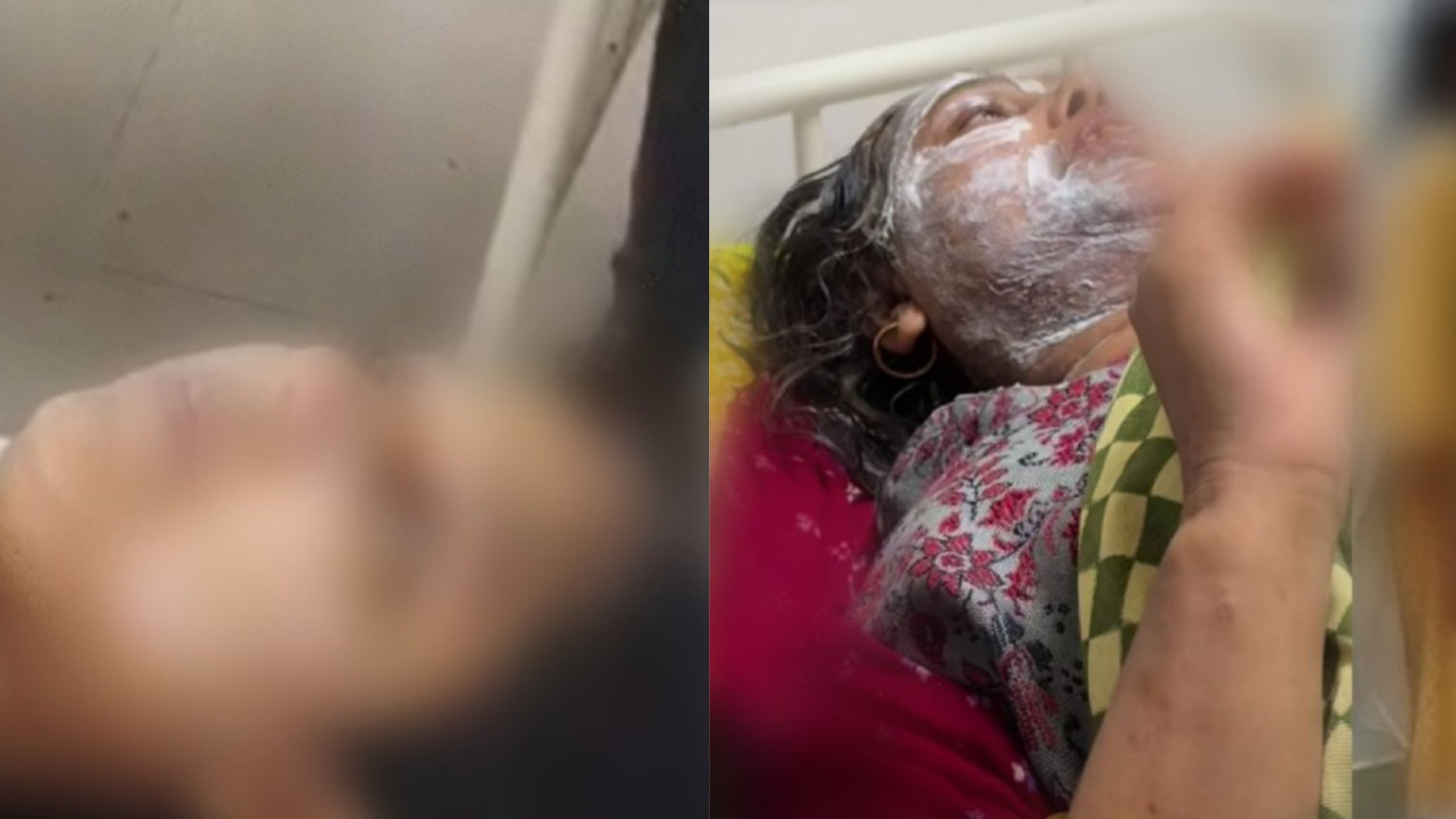 A jeweller in Bihar's Madhepura allegedly threw acid on a mother and daughter who visited his shop to collect jewellery ahead of a family wedding.