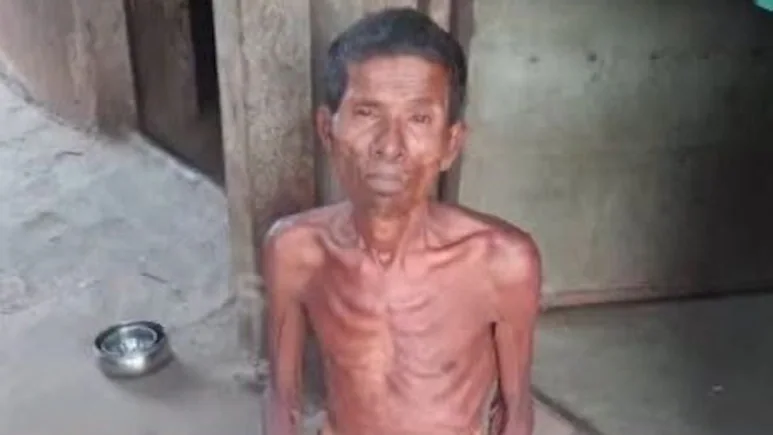 A 59-year-old man in Odisha's Dhenkanal district was arrested for allegedly repeatedly raping his 21-year-old specially-abled daughter, who later delivered a baby girl.