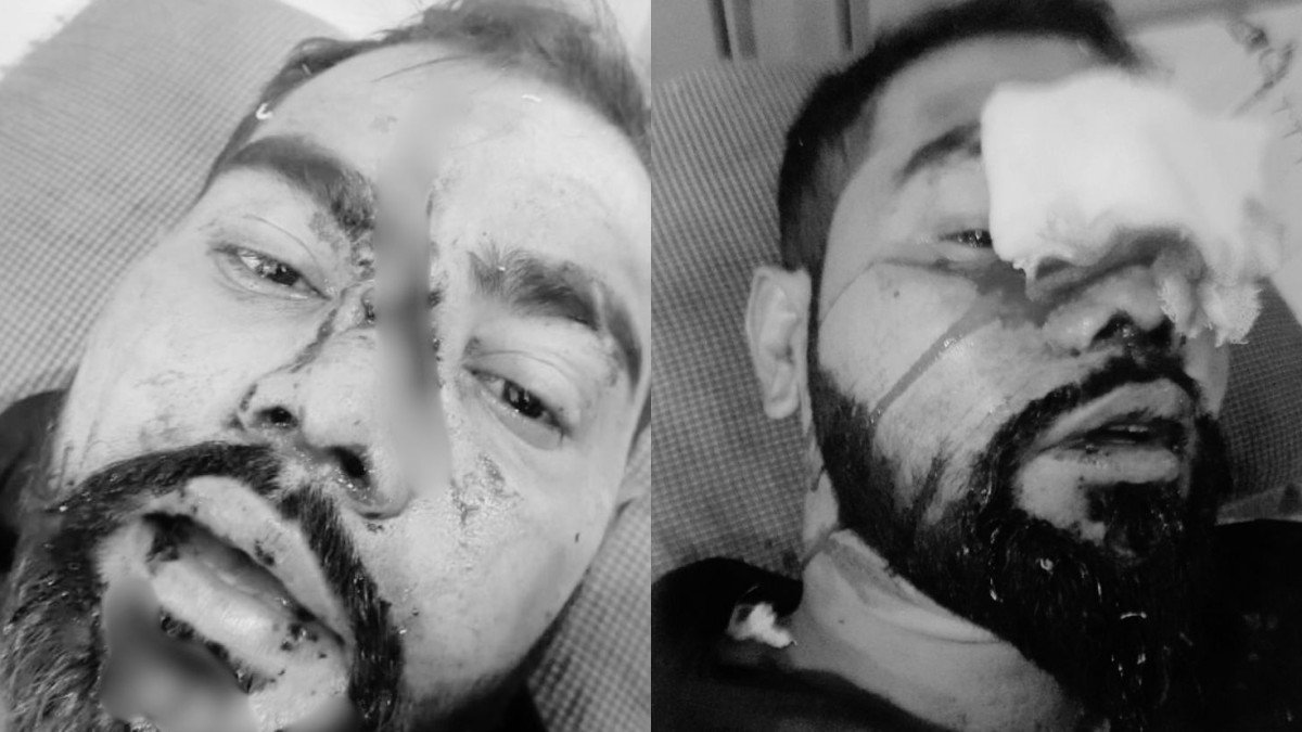 Armed gang assaults Muslim lorry driver and helper on highway; victims hospitalised.