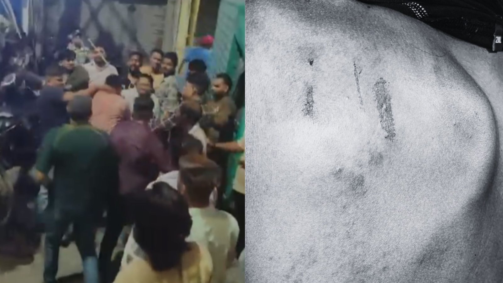 Delhi: Muslim Family Alleges Assault by Mob in Shakurpur, Pregnant Woman Says Threatened With Rape