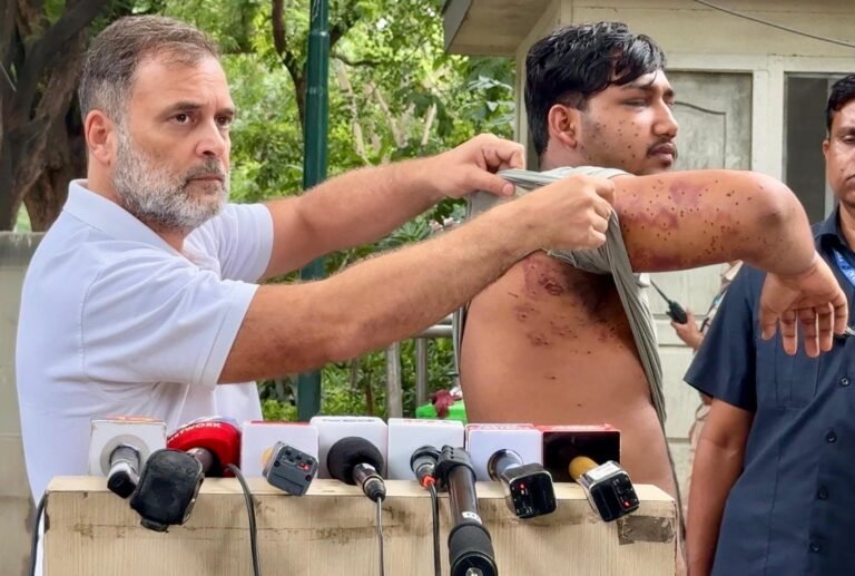 ‘Government Fired at India’s Future’: Rahul Gandhi Says Pellet Guns Used on Students, Seeks Pradhan’s Resignation