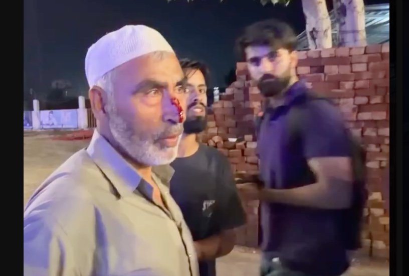‘Called Us Terrorists’: Elderly Kashmiri Injured as Bus From Delhi to Srinagar Is Attacked